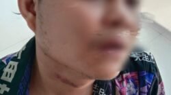 AS Tak Minum Obat Lebih dari Dua Pekan, Kuasa Hukum Minta Penanganan Dokter Spesialis Jiwa Segera