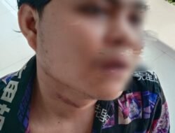 AS Tak Minum Obat Lebih dari Dua Pekan, Kuasa Hukum Minta Penanganan Dokter Spesialis Jiwa Segera